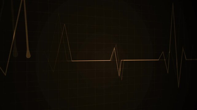 Glowing heartbeat line grid background medical pulse graph with a dramatic spike animation