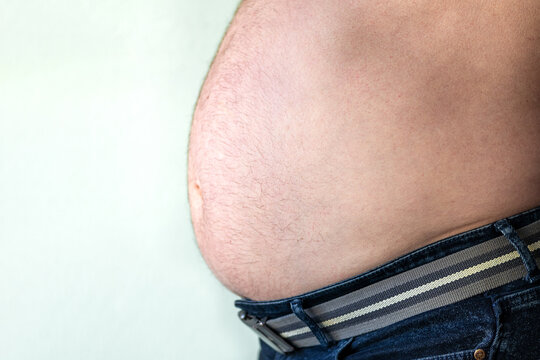 Close-up of overweight belly and abdomen spilling over jeans with striped belt