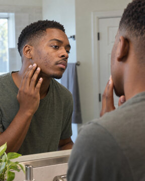 Young Black man examining acne and dark spots in bathroom mirror