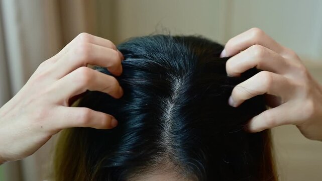 Close up of woman having itchy problem on her head cause of dandruff.