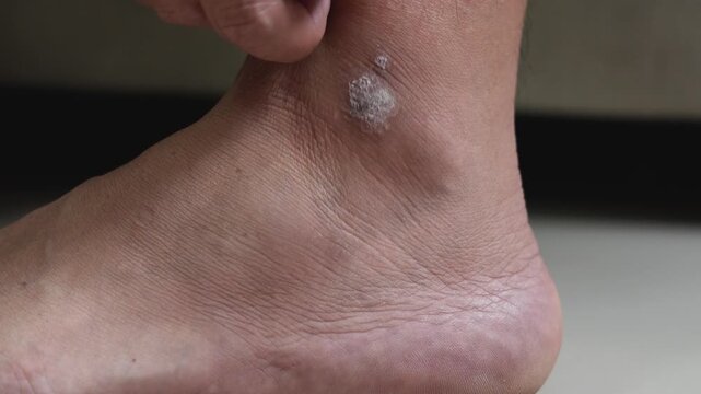 Men experience itchy legs due to germs and bacteria.
