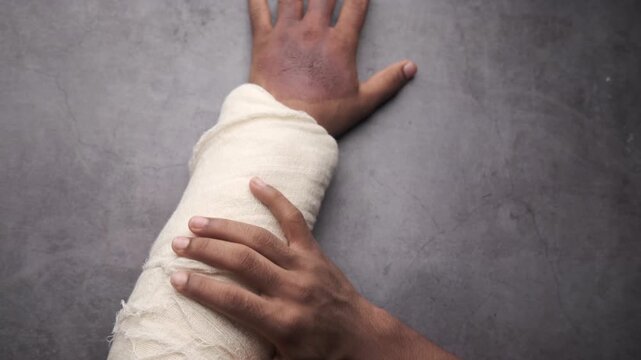 Close up top view of hand in gauze bandage with an injured bruised hand on dark background shows trauma, pain, and need for medical care or treatment