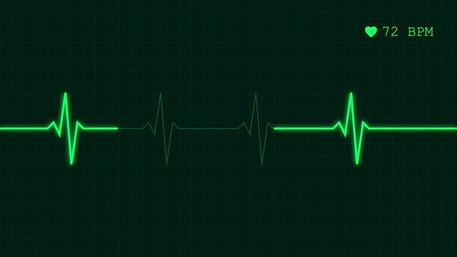 Heart rate monitor pulse animation showing bpm line on ecg screen for medical health concept
