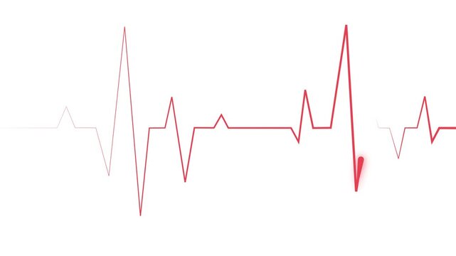 Heartbeat line electrocardiogram style pulse graph with sharp spikes and a minimal medical theme animation