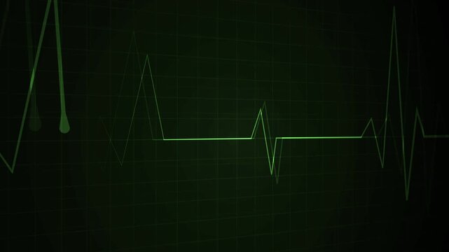 Glowing heartbeat line grid background medical pulse graph with a dramatic spike animation