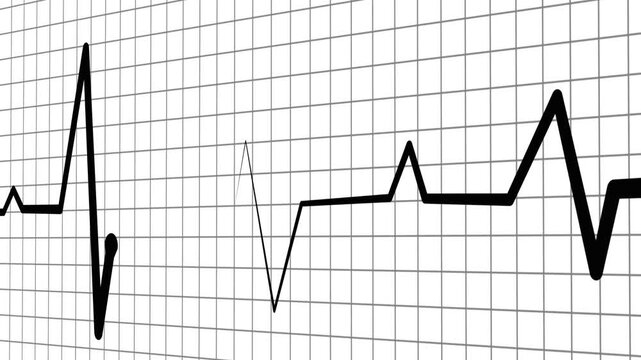 Irregular heartbeat line flat start and end, showing a medical ecg pattern and heart rhythm problem animation