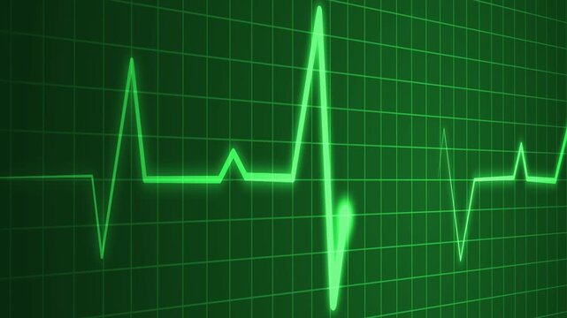 Irregular heartbeat line flat start and end, showing a medical ecg pattern and heart rhythm problem animation