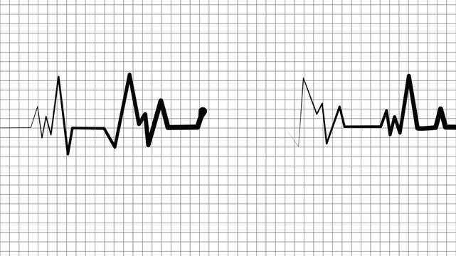 Heartbeat line irregular electrocardiogram pattern animation