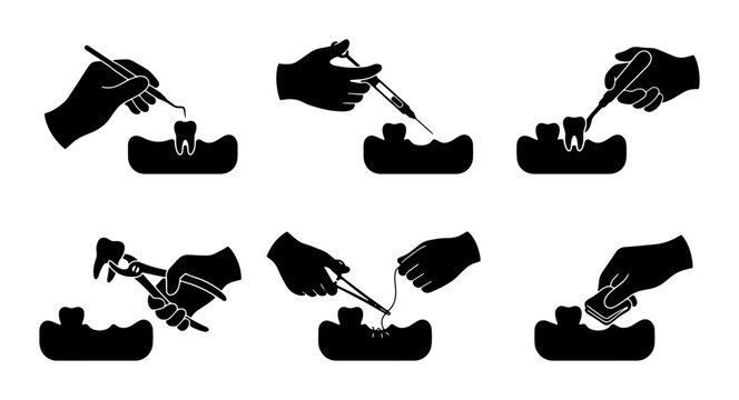 Black dental procedure icons, tooth extraction and care graphics