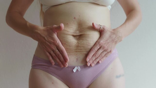 Woman touching loose abdominal skin after childbirth, focusing on postpartum body changes, closeup, 4K