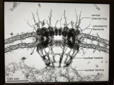  Desmosome Intercellular Junction

