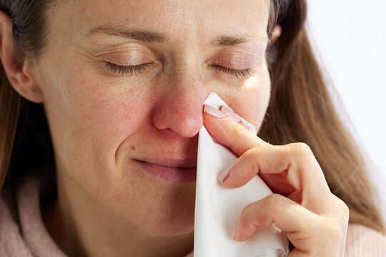 Close-up of a woman with a flushed face dabbing her nose with a white tissue, managing cold or allergy symptoms in a bright studio setting.