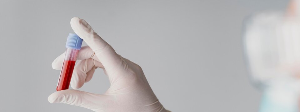 Doctor Holding Blood Sample Tube with Medical Glove