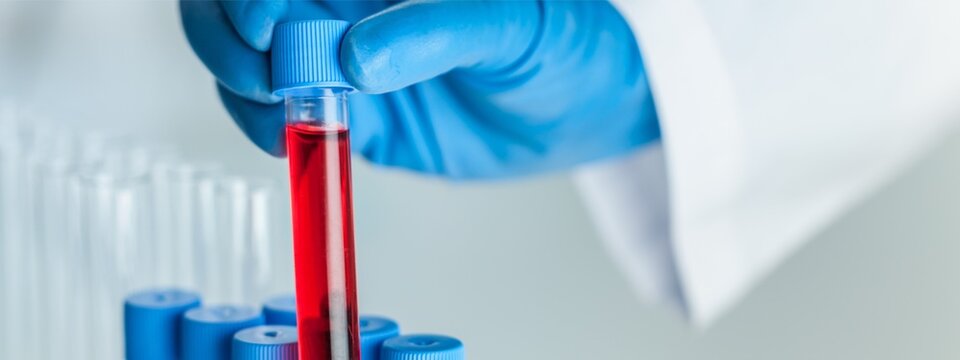 Lab Technician Holding Blood Sample Tube, Multiple Vials Background