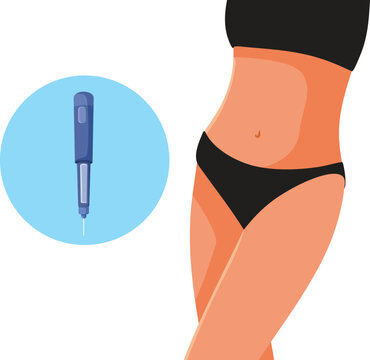 Subcutaneous Injection Next to  Abdomen And Thigh Areas Vector Illustration. Vector illustration depicting proper medical subcutaneous injection locations on female abdomen and thigh 
