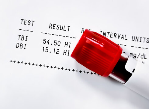Abnormal report of Bilirubil (total and Direct), May be due to sever liver damage icluding Bile Duct Blockages, Post-Hepatic Obstruction, Dubin-Johnson syndrome, Rotor syndrome etc.