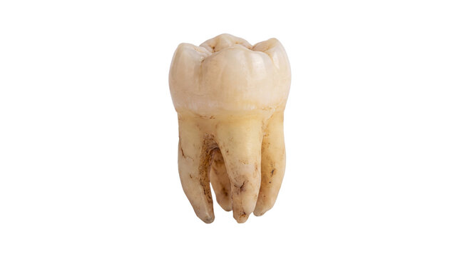 Extracted human molar tooth with visible roots, decayed wisdom tooth for dental education, anatomical specimen of a permanent tooth isolated PNG with Transparent Background