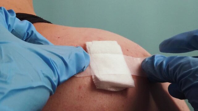Medical worker secures gauze dressing on treated shoulder skin. A gloved medical worker places and presses a sterile gauze dressing onto treated shoulder skin.