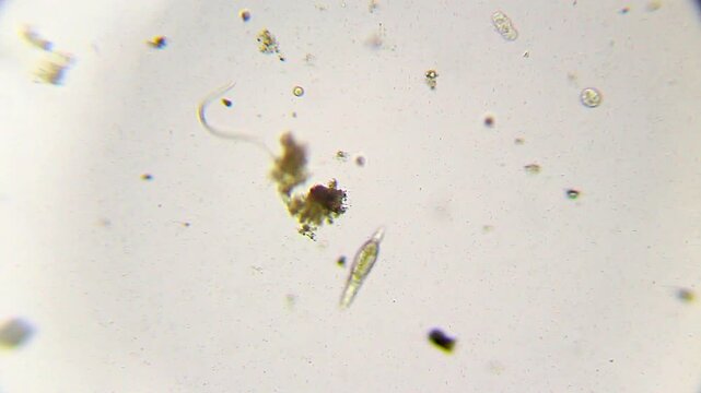 Small nematode roundworm moving next to a swimming rotifer under 100x brightfield microscopy