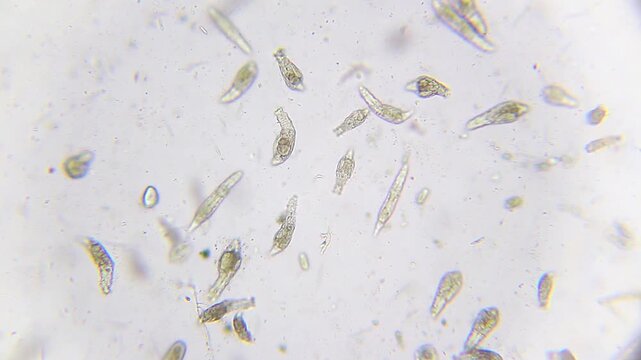 Massive colony of active rotifers swimming among ciliates and bacteria under 100x brightfield microscopy