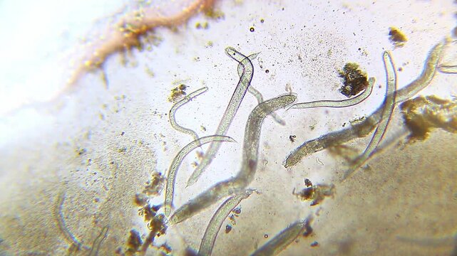 Immobile nematode roundworms in contaminated water under 100x brightfield microscopy