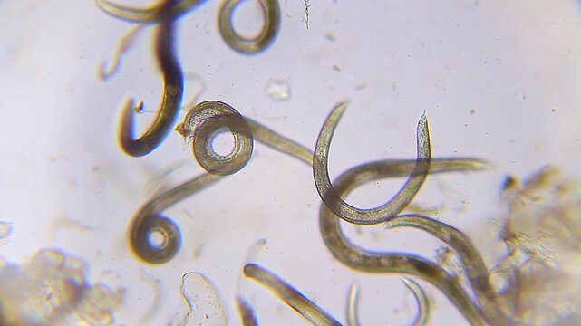 Nematode roundworms moving through organic sediment in dirty water drop under 100x brightfield microscopy