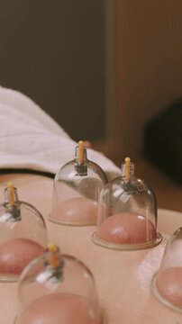 transparent cups rest on bare skin as suction pump lifts surface during warm spa treatment in clinic