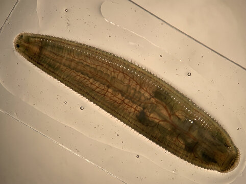 A highly magnified microscopic image of a leech under a light microscope