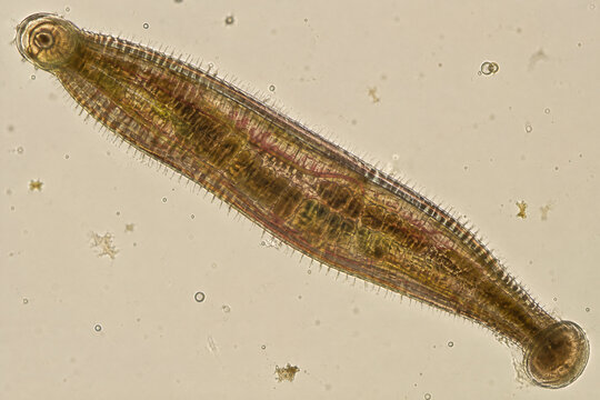 A highly magnified microscopic image of a leech under a light microscope