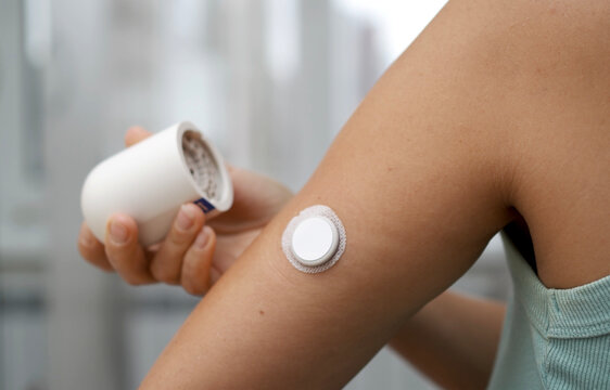 Woman Applying Continuous Glucose Monitor CGM Sensor to Arm