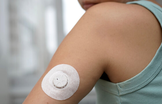 Close-up of a female patient attaching a continuous glucose monitoring sensor to the back of her upper arm using an automatic applicator at home.