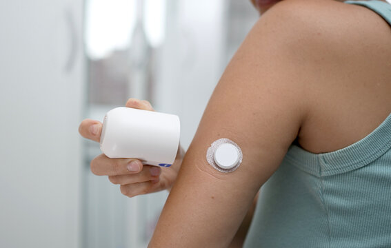Woman Applying Continuous Glucose Monitor CGM Sensor to Arm