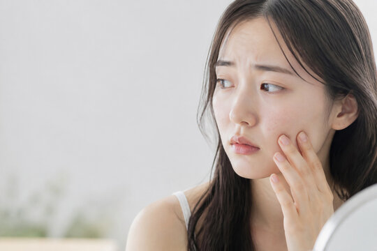 肌荒れやニキビに悩み頬に触れる若い女性