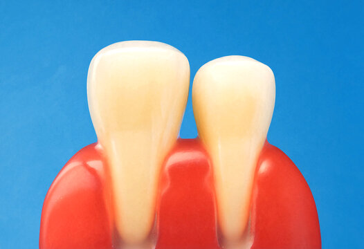 Realistic model of two human teeth embedded in red gum tissue