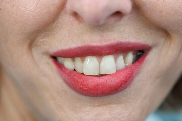 Obraz premium Close-up of smiling mouth with red lips and white teeth