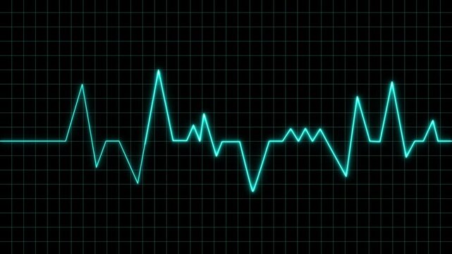 Cyan heartbeat line graph animation pulses over a black grid. Medical cardiogram monitor telemetry traces the heartbeat line graph. Vital patient pulse rates drive this heartbeat line.