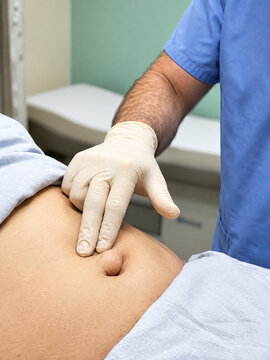 Medical doctor examining a patient with a paraumbilical hernia in clinic