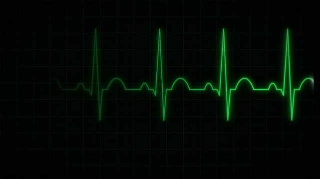 ECG Heart Rate Patient Monitor Screen with Glowing Neon Green Pulse Line Seamless Loop