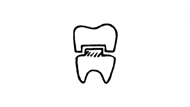 Animated doodle icon of a dental crown cap fitting over a damaged tooth root.