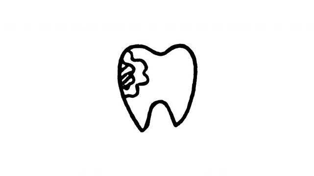 Animated doodle icon of a tooth with a black cavity hole showing tooth decay and ache.