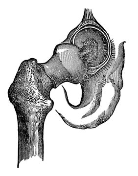 Vintage medical engraving of the human hip joint unlabeled