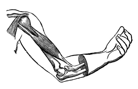 Vintage anatomical engraving of a half contracted biceps