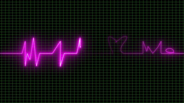 Electrocardiogram visualization presents a bright purple pulse signal tracking human heartbeat rhythm over a digital hospital monitor display grid during routine patient health examinations.