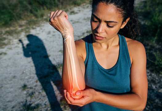 Athletic woman holding injured elbow joint outdoors during workout with red glowing x-ray overlay indicating bone pain or inflammation