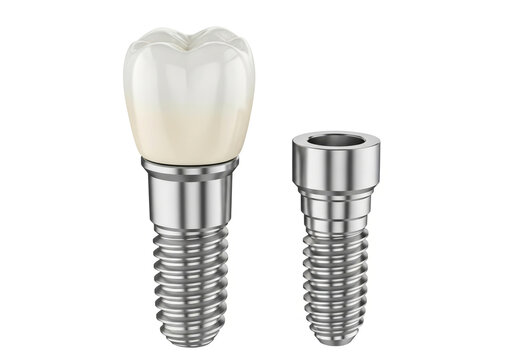 Dental implant with crown and metal post for teeth replacement