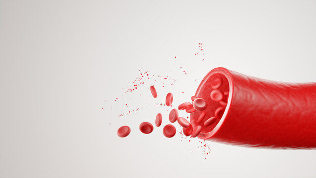 Red blood cells splashing out of open artery on white background 3d rendering