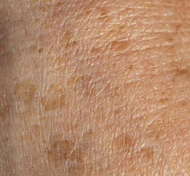 Close-up of aged skin with visible wrinkles and age spots