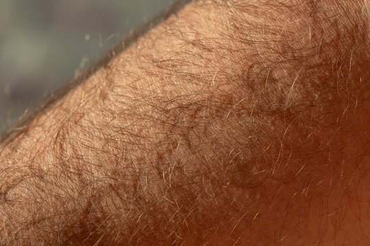 Close-up of dense, light brown human arm hair