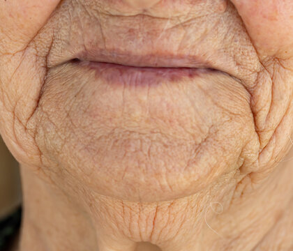 Close-up of elderly person's mouth and chin