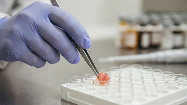 researcher in lab handling tissue sample with tweezers in test tray